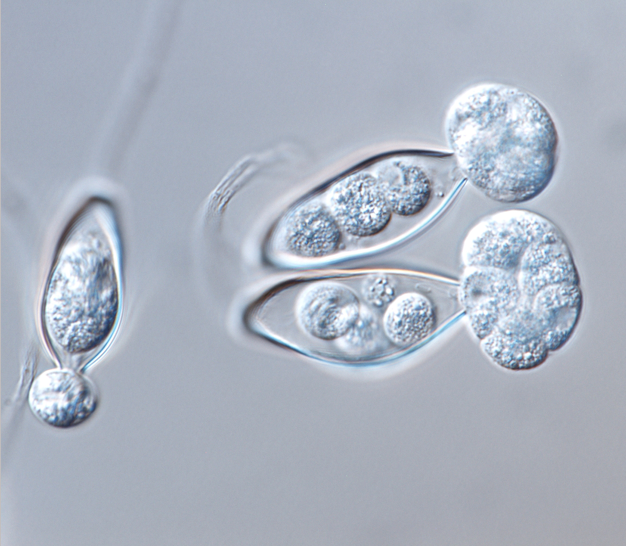   Phytophthora tropicalisnbsp; asexual phase of ex-type CPHST BL 58 formed on V8 agar flooded with soil extract:nbsp;sporangia releasing zoospores; photonbsp;by Gloria Abad, USDA-APHIS-PPQ. 
